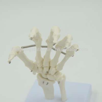 Life-size Anatomical Skeleton Hand, hand bone model, 1:1 professional bone model for education